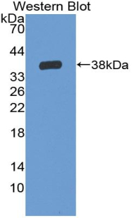 IL6R / IL6 Receptor Antibody - Western blot of IL6R / IL6 Receptor antibody.
