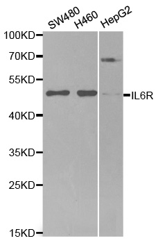 IL6R / IL6 Receptor Antibody - Western blot analysis of extracts of various cell lines, using IL6R antibody at 1:1000 dilution. The secondary antibody used was an HRP Goat Anti-Rabbit IgG (H+L) at 1:10000 dilution. Lysates were loaded 25ug per lane and 3% nonfat dry milk in TBST was used for blocking.