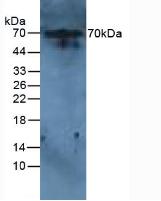 IL6R / IL6 Receptor Antibody - Western Blot; Sample: Rat Liver Tissue.