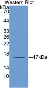 IL6R / IL6 Receptor Antibody - Western blot of IL6R / IL6 Receptor antibody.