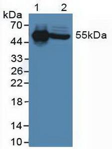 IL6R / IL6 Receptor Antibody - Western Blot; Sample: Lane1: Human Serum; Lane2: Human Liver Tissue.
