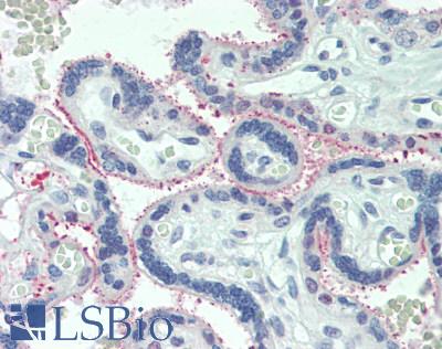 IL6R / IL6 Receptor Antibody - Human Placenta: Formalin-Fixed, Paraffin-Embedded (FFPE)