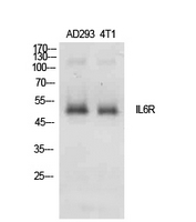 IL6R / IL6 Receptor Antibody - Western Blot analysis of extracts from AD293, 4T1 cells using IL6R Antibody.