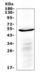 IL6R / IL6 Receptor Antibody - Western blot analysis of IL6R using anti-IL6R antibody. Electrophoresis was performed on a 5-20% SDS-PAGE gel at 70V (Stacking gel) / 90V (Resolving gel) for 2-3 hours. The sample well of each lane was loaded with 50ug of sample under reducing conditions. Lane 1: human A549 whole cell lysate. After Electrophoresis, proteins were transferred to a Nitrocellulose membrane at 150mA for 50-90 minutes. Blocked the membrane with 5% Non-fat Milk/ TBS for 1.5 hour at RT. The membrane was incubated with rabbit anti-IL6R antigen affinity purified polyclonal antibody at 0.5 µg/mL overnight at 4°C, then washed with TBS-0.1% Tween 3 times with 5 minutes each and probed with a goat anti-rabbit IgG-HRP secondary antibody at a dilution of 1:10000 for 1.5 hour at RT. The signal is developed using an Enhanced Chemiluminescent detection (ECL) kit with Tanon 5200 system. A specific band was detected for IL6R at approximately 52KD. The expected band size for IL6R is at 52KD.