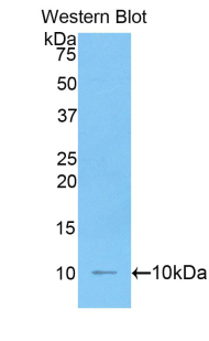 IL6R / IL6 Receptor Antibody - Western blot of recombinant IL6R / IL6 Receptor.  This image was taken for the unconjugated form of this product. Other forms have not been tested.