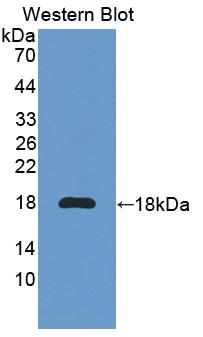 IL6R / IL6 Receptor Antibody - Western Blot; Sample: Recombinant protein.