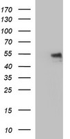 IL6R / IL6 Receptor Antibody - HEK293T cells were transfected with the pCMV6-ENTRY control (Left lane) or pCMV6-ENTRY IL6R (Right lane) cDNA for 48 hrs and lysed. Equivalent amounts of cell lysates (5 ug per lane) were separated by SDS-PAGE and immunoblotted with anti-IL6R.