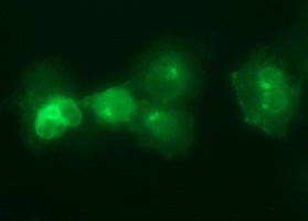 IL6R / IL6 Receptor Antibody - Anti-IL6R mouse monoclonal antibody immunofluorescent staining of COS7 cells transiently transfected by pCMV6-ENTRY IL6R.
