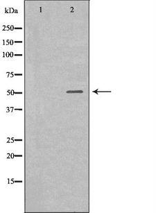 IL6R / IL6 Receptor Antibody - Western blot analysis of Jurkat whole cells lysates using IL-6R antibody. The lane on the left is treated with the antigen-specific peptide.