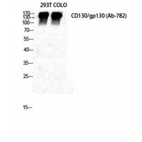 IL6ST / CD130 / gp130 Antibody - Western blot of CD130 antibody