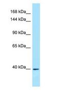 IL6ST / CD130 / gp130 Antibody - CD130 / IL6ST / gp130 antibody Western Blot of MDA-MB-435S.  This image was taken for the unconjugated form of this product. Other forms have not been tested.