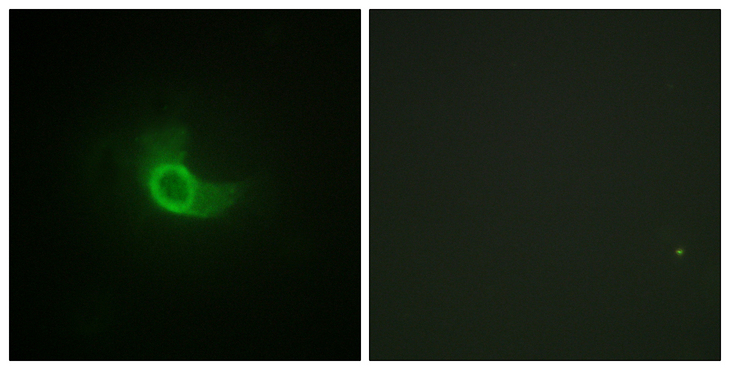 IL6ST / CD130 / gp130 Antibody - Immunofluorescence analysis of NIH/3T3 cells, using CD130/gp130 Antibody. The picture on the right is blocked with the synthesized peptide.