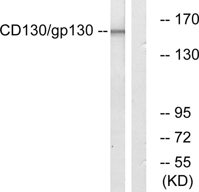 IL6ST / CD130 / gp130 Antibody - Western blot analysis of lysates from Jurkat cells, using CD130/gp130 Antibody. The lane on the right is blocked with the synthesized peptide.