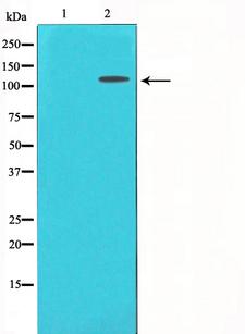 IL6ST / CD130 / gp130 Antibody - Western blot analysis of CD130/gp130 expression in Jurkat whole cells lysates. The lane on the left is treated with the antigen-specific peptide.