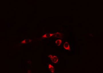 IL6ST / CD130 / gp130 Antibody - Staining HeLa cells by IF/ICC. The samples were fixed with PFA and permeabilized in 0.1% Triton X-100, then blocked in 10% serum for 45 min at 25°C. The primary antibody was diluted at 1:200 and incubated with the sample for 1 hour at 37°C. An Alexa Fluor 594 conjugated goat anti-rabbit IgG (H+L) antibody, diluted at 1/600, was used as secondary antibody.