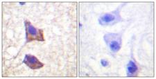 IL6ST / CD130 / gp130 Antibody - Peptide - + Immunohistochemistry analysis of paraffin-embedded human brain tissue, using CD130/gp130 (Ab-782) antibody.