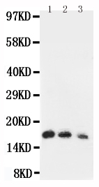 IL7 Antibody - Anti-human IL7 antibody, Western blotting Lane 1: Recombinant Human IL-7 Protein 10ng Lane 2: Recombinant Human IL-7 Protein 5ng Lane 3: Recombinant Human IL-7 Protein 2