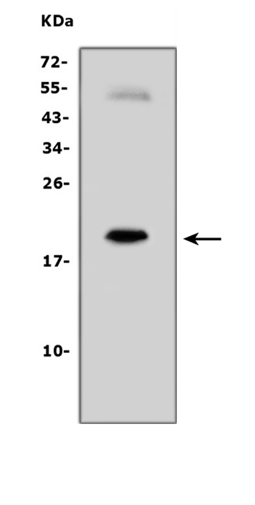 IL7 Antibody - Western blot analysis of IL7 using anti-IL7 antibody. Electrophoresis was performed on a 5-20% SDS-PAGE gel at 70V (Stacking gel) / 90V (Resolving gel) for 2-3 hours. The sample well of each lane was loaded with 50ug of sample under reducing conditions. Lane 1: human PC-3 whole cell lysates. After Electrophoresis, proteins were transferred to a Nitrocellulose membrane at 150mA for 50-90 minutes. Blocked the membrane with 5% Non-fat Milk/ TBS for 1.5 hour at RT. The membrane was incubated with rabbit anti-IL7 antigen affinity purified polyclonal antibody at 0.5 µg/mL overnight at 4°C, then washed with TBS-0.1% Tween 3 times with 5 minutes each and probed with a goat anti-rabbit IgG-HRP secondary antibody at a dilution of 1:10000 for 1.5 hour at RT. The signal is developed using an Enhanced Chemiluminescent detection (ECL) kit with Tanon 5200 system. A specific band was detected for IL7 at approximately 20KD. The expected band size for IL7 is at 20KD.