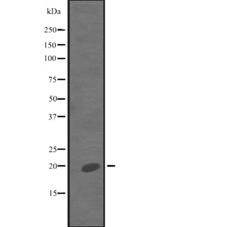 IL7 Antibody - Western blot analysis of IL7 expression in human kidney tissue lysate. The lane on the left is treated with the antigen-specific peptide.