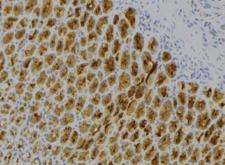 IL7 Antibody - 1:100 staining human pancreas tissue by IHC-P. The sample was formaldehyde fixed and a heat mediated antigen retrieval step in citrate buffer was performed. The sample was then blocked and incubated with the antibody for 1.5 hours at 22°C. An HRP conjugated goat anti-rabbit antibody was used as the secondary.