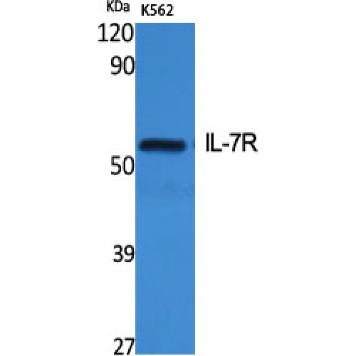 IL7R / CD127 Antibody - Western blot of IL-7R antibody