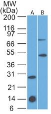 IL7R / CD127 Antibody - Western Blot: IL7 Receptor alpha Antibody (73N8F2) [Azide Free] - Western blot analysis of A) IL-17R recombinant protein fragment and B) mouse thymus lysate using this antibody at 2 ug/ml. This image was taken for the unmodified form of this product. Other forms have not been tested.
