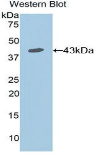 IL7R / CD127 Antibody - Western blot of recombinant IL7R / CD127.  This image was taken for the unconjugated form of this product. Other forms have not been tested.