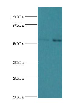 IL7R / CD127 Antibody - Western blot. All lanes: Interleukin-7 receptor subunit alpha antibody at 4 ug/ml. Lane 1: K562 whole cell lysate. Lane 2: Jurkat whole cell lysate. Secondary antibody: Goat polyclonal to rabbit at 1:10000 dilution. Predicted band size: 52 kDa. Observed band size: 52 kDa.