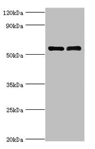 IL7R / CD127 Antibody - Western blot All lanes: IL7R antibody at 4µg/ml Lane 1: K562 whole cell lysate Lane 2: Jurkat whole cell lysate Secondary Goat polyclonal to rabbit IgG at 1/10000 dilution Predicted band size: 52, 35, 30, 29 kDa Observed band size: 52 kDa