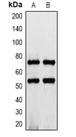 IL7R / CD127 Antibody - Western blot analysis of CD127 expression in K562 (A); rat heart (B) whole cell lysates.