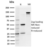 IL7R / CD127 Antibody - SDS-PAGE analysis of purified, BSA-free CD127 antibody (clone IL7R/2751) as confirmation of integrity and purity.