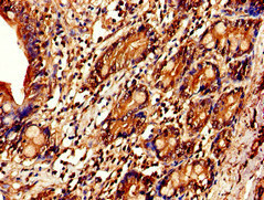 IL7R / CD127 Antibody - Immunohistochemistry of paraffin-embedded human small intestine tissue at dilution of 1:100