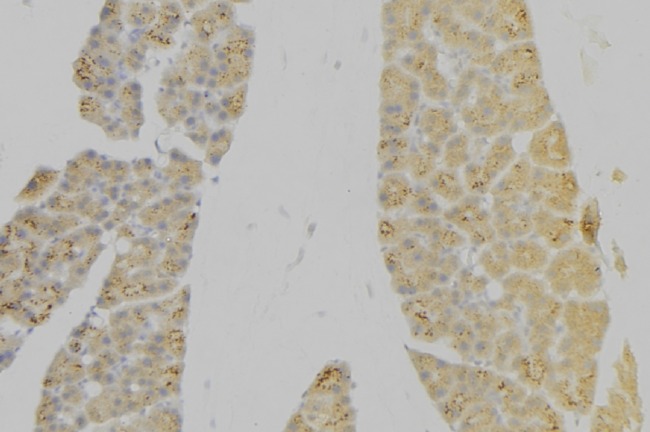 IL7R / CD127 Antibody - 1:100 staining human pancreas tissue by IHC-P. The sample was formaldehyde fixed and a heat mediated antigen retrieval step in citrate buffer was performed. The sample was then blocked and incubated with the antibody for 1.5 hours at 22°C. An HRP conjugated goat anti-rabbit antibody was used as the secondary.
