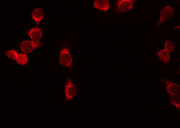 IL7R / CD127 Antibody - Staining HeLa cells by IF/ICC. The samples were fixed with PFA and permeabilized in 0.1% Triton X-100, then blocked in 10% serum for 45 min at 25°C. The primary antibody was diluted at 1:200 and incubated with the sample for 1 hour at 37°C. An Alexa Fluor 594 conjugated goat anti-rabbit IgG (H+L) Ab, diluted at 1/600, was used as the secondary antibody.