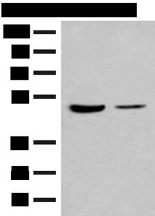 IL7R / CD127 Antibody - Western blot analysis of Human fetal brain tissue and Jurkat cell lysates  using IL7R Polyclonal Antibody at dilution of 1:500