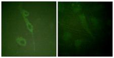 IL7R / CD127 Antibody - Immunofluorescence analysis of HUVEC cells, using IL-7R/CD127 (Phospho-Tyr449) Antibody. The picture on the right is blocked with the phospho peptide.