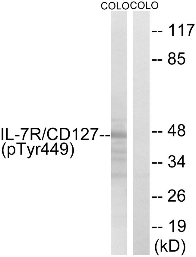IL7R / CD127 Antibody - Western blot analysis of lysates from COLO205 cells, using IL-7R/CD127 (Phospho-Tyr449) Antibody. The lane on the right is blocked with the phospho peptide.