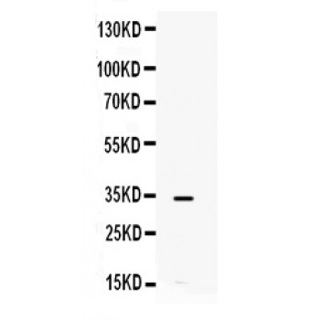 IL8 / Interleukin 8 Antibody - IL8 antibody Western blot. All lanes: Anti IL8 at 0.5 ug/ml. WB: HELA Whole Cell Lysate at 40 ug. Predicted band size: 11 kD. Observed band size: 34 kD.