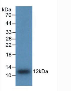 IL8 / Interleukin 8 Antibody - Western Blot; Sample: Recombinant IL8, Human.