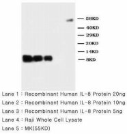 IL8 / Interleukin 8 Antibody -  This image was taken for the unconjugated form of this product. Other forms have not been tested.