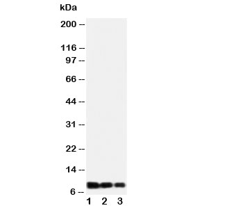 IL8 / Interleukin 8 Antibody - Western blot testing of IL-8 antibody and Lane 1: recombinant human protein 10ng; 2: 5ng; 3: 2.5ng