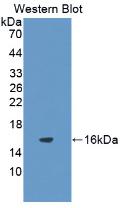 IL8 / Interleukin 8 Antibody