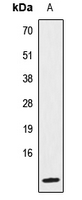 IL8 / Interleukin 8 Antibody - Western blot analysis of IL-8 expression in HeLa (A) whole cell lysates.