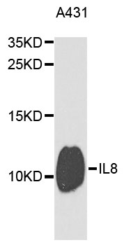 IL8 / Interleukin 8 Antibody - Western blot analysis of extracts of A431 cells.