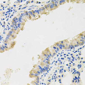 IL8 / Interleukin 8 Antibody - Immunohistochemistry of paraffin-embedded mouse lung tissue.
