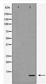 IL8 / Interleukin 8 Antibody - Western blot of Interleukin?8 expression in HeLa cells,