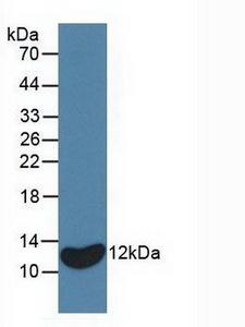 IL8 / Interleukin 8 Antibody