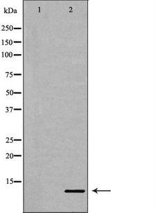 IL8 / Interleukin 8 Antibody - Western blot analysis of extracts of mouse liver tissue using IL8 antibody. The lane on the left is treated with the antigen-specific peptide.