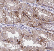 IL8 / Interleukin 8 Antibody - 1/100 staining human kidney tissue by IHC-P. The sample was formaldehyde fixed and a heat mediated antigen retrieval step in citrate buffer was performed. The sample was then blocked and incubated with the antibody for 1.5 hours at 22°C. An HRP conjugated goat anti-rabbit antibody was used as the secondary antibody.