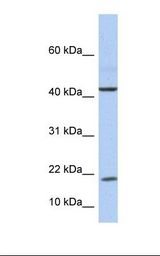 IL9 Antibody - Fetal liver lysate. Antibody concentration: 1.0 ug/ml. Gel concentration: 10-20%.  This image was taken for the unconjugated form of this product. Other forms have not been tested.